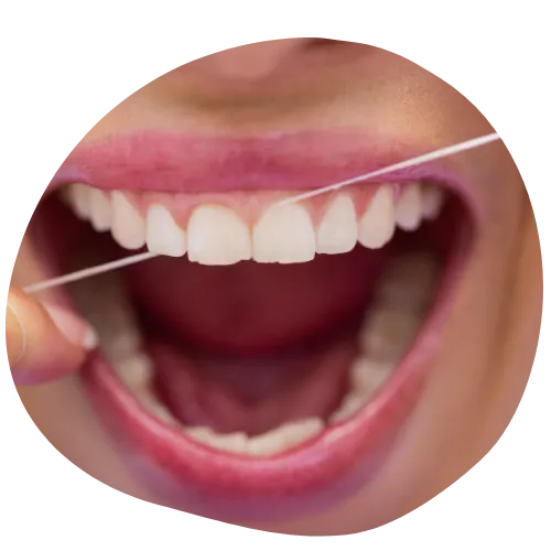 Periodontoloji Tedavisi